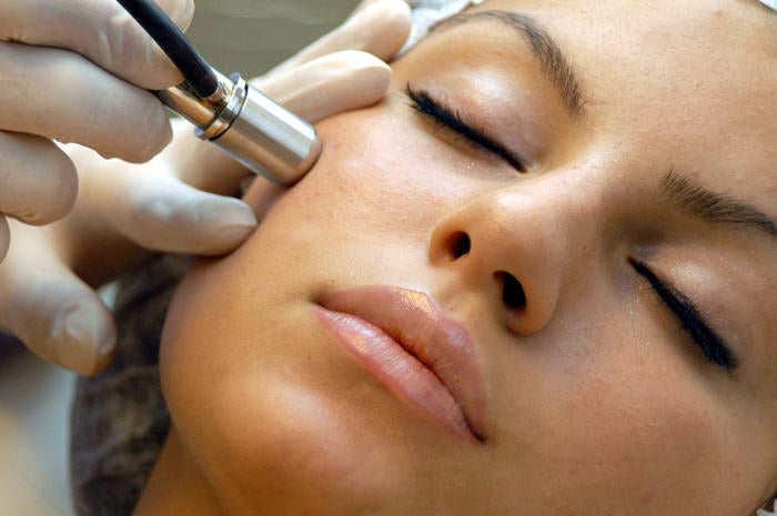 Facial Microdermabrasion