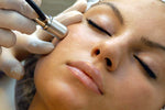 Facial Microdermabrasion