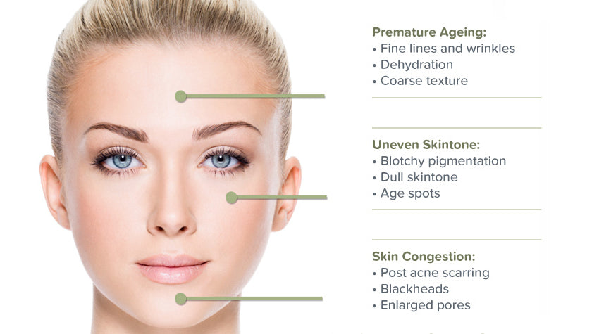 Facial Microdermabrasion